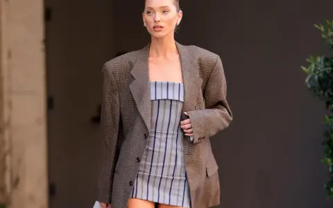 Frau im karierten Blazer und gestreiftem Kleid. Der Blazer muss dringend gewaschen werden, um den Fleck zu entfernen.