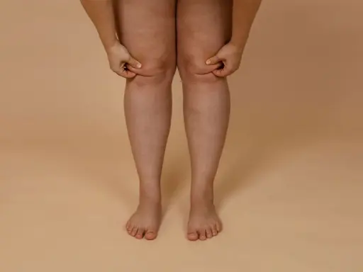Frau greift an ihre Knie, um Fett an Knie Innenseite zu trainieren.