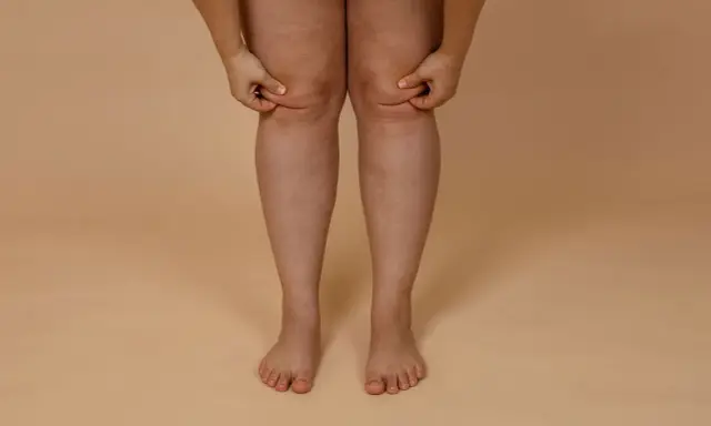 Frau greift an ihre Knie, um Fett an Knie Innenseite zu trainieren.